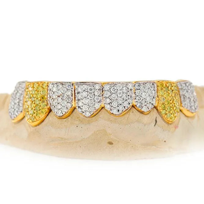 JDTK-101 - 8 TOP OR 8 BOTTOM SI Hand prong Diamond Grillz – Johnny