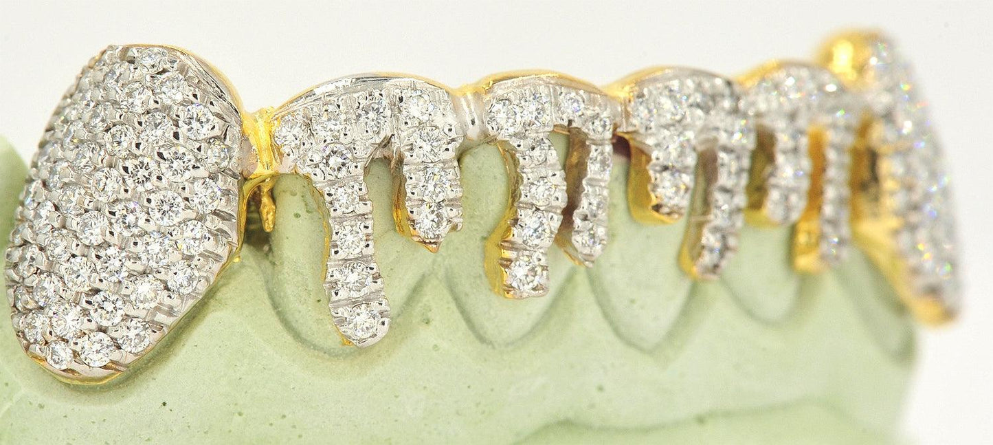 JDTK-2024 - 6 TOP OR 6 BOTTOM SI Hand prong Dripping Diamond Grillz - Johnny Dang & Co