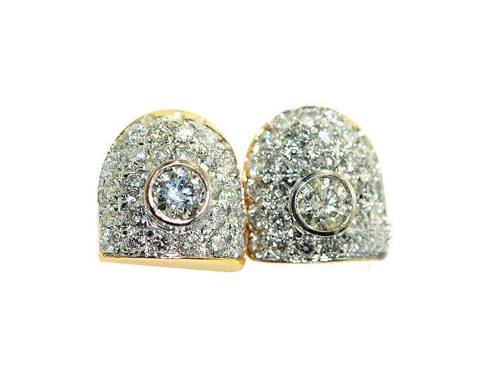 JDTK-S2530075c Permanent Prong and Bezel Set Gold Teeth - Johnny Dang & Co