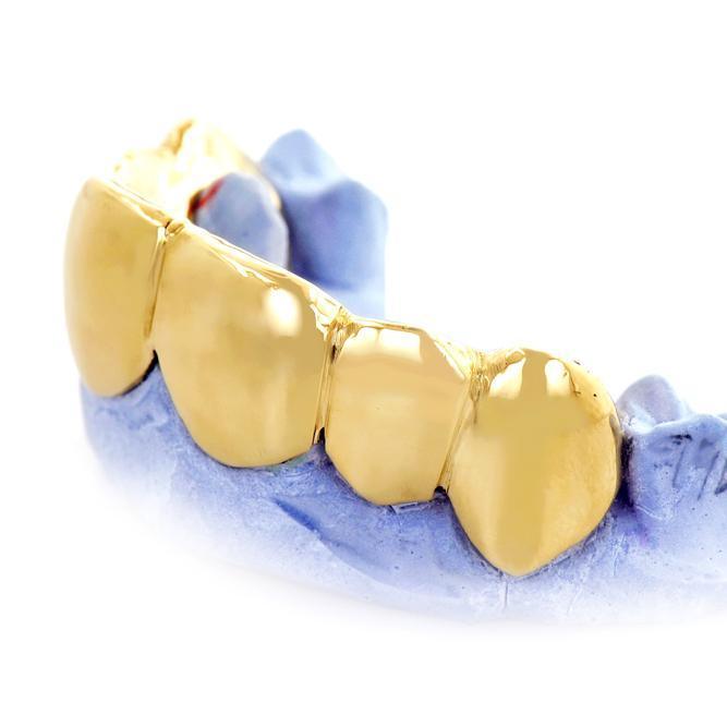 JDTK-- JDG43- 6 Piece " Built up" Gold Grill - Johnny Dang & Co
