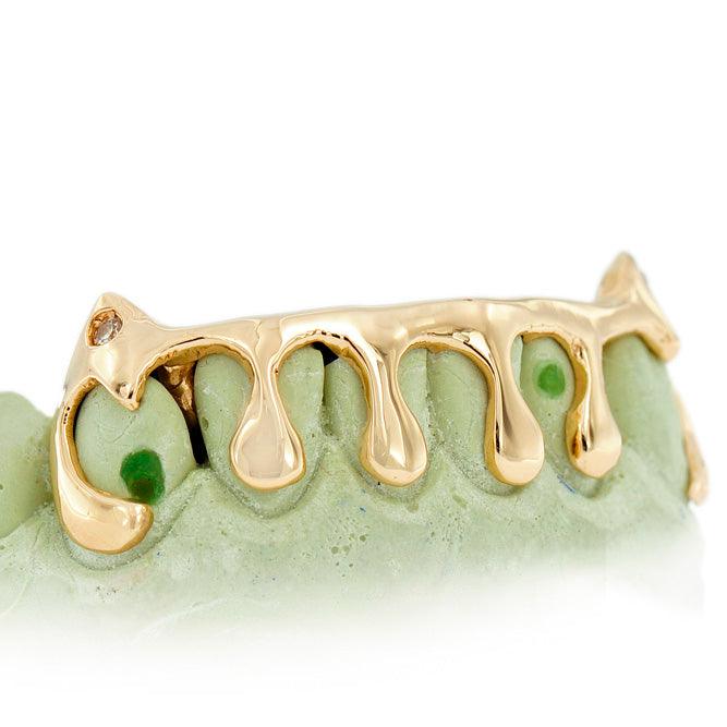 Custom Grillz Gold Teeth with Dripping Diamond dust