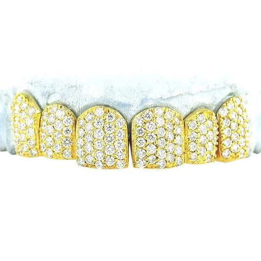 JDTK-S151806-2-NEW -18K Individual Diamond Prong Set Permanent Teeth - Johnny Dang & Co