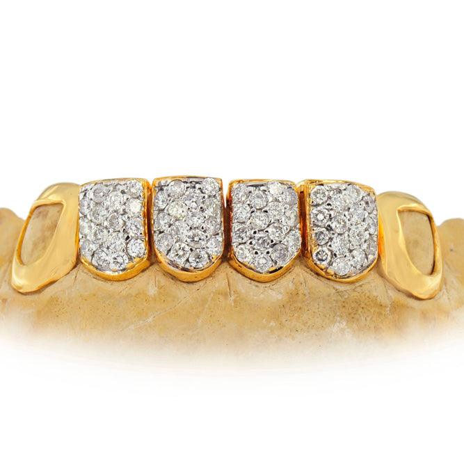 Yellow and White Gold Heart Open Face Diamond Cut Grillz