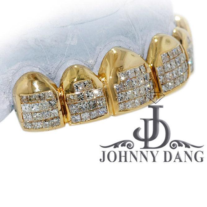 Grills Diamond Teeth Johnny Dang Grills Teeth Johnny Dang Paul