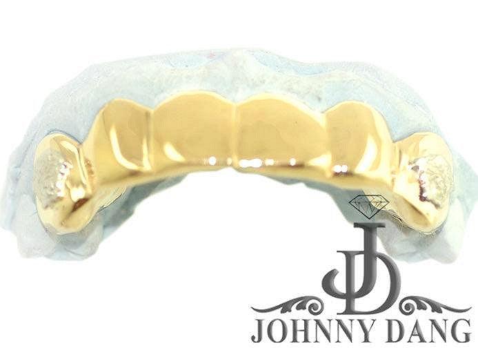 JDTK-S2530073 Custom Gold Teeth - Johnny Dang & Co