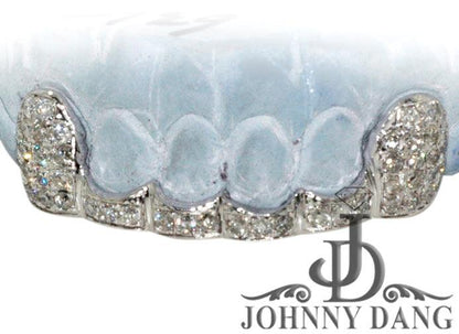 JDTK-G20 Beyonce's Hand Prong Set Diamond Grill - Johnny Dang & Co