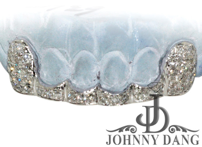 JDTK-G20 Beyonce's Hand Prong Set Diamond Grill