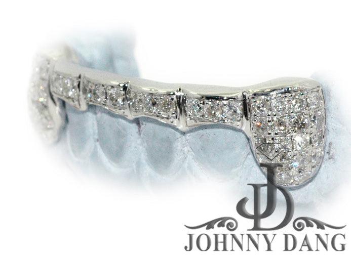 JDTK-G20 Beyonce's Hand Prong Set Diamond Grill - Johnny Dang & Co