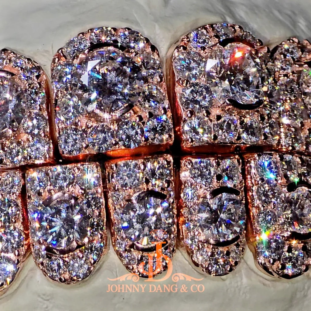 JDWR-2026-34 NO GIA "Honeymoon" Set Grillz Rose Gold (Perms)