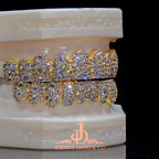 JDWR-2026-30 Flawless Mosaic Set Grillz Yellow Gold (Pull Out)