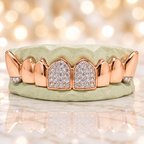 JDWR-S2530030 - Gold Teeth