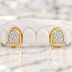 JDWR-0047-2 PRONG SET CUSTOM COLOR DIAMOND TEETH