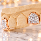 JDWR-0047-2 PRONG SET CUSTOM COLOR DIAMOND TEETH