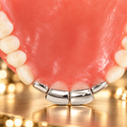JDWR-DTG1 - FOUR INDIVIDUAL TEETH DENTURE GRILL