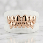Diamond Dust Grillz