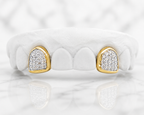 JDWR-0047-2 PRONG SET CUSTOM COLOR DIAMOND TEETH