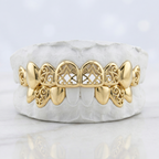 JDWR-S2530073 Custom Gold Teeth
