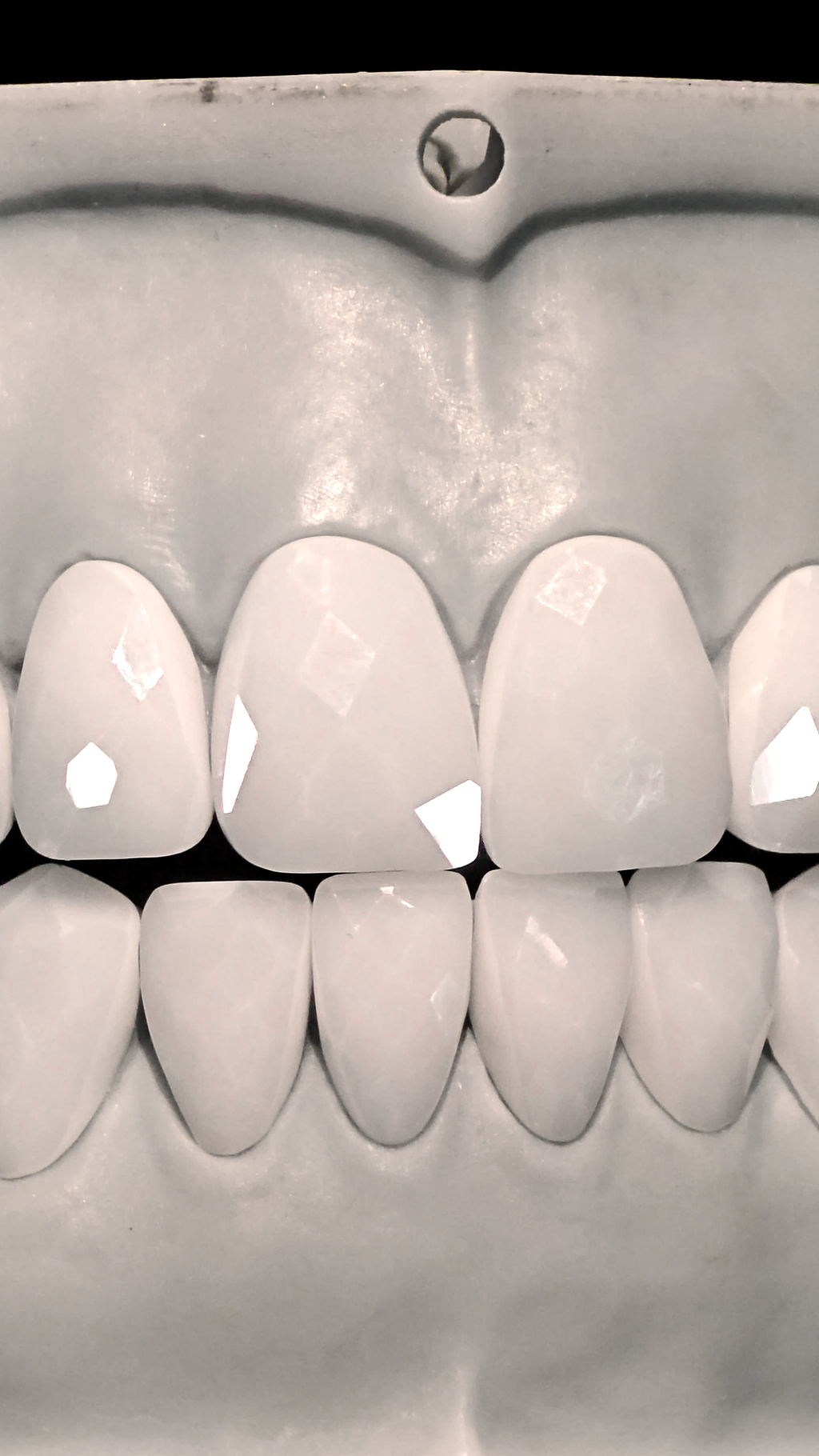 JDWR-V1-CUSTOM-DENTAL-VENEERS