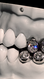 JDWR-V1-CUSTOM-DENTAL-VENEERS