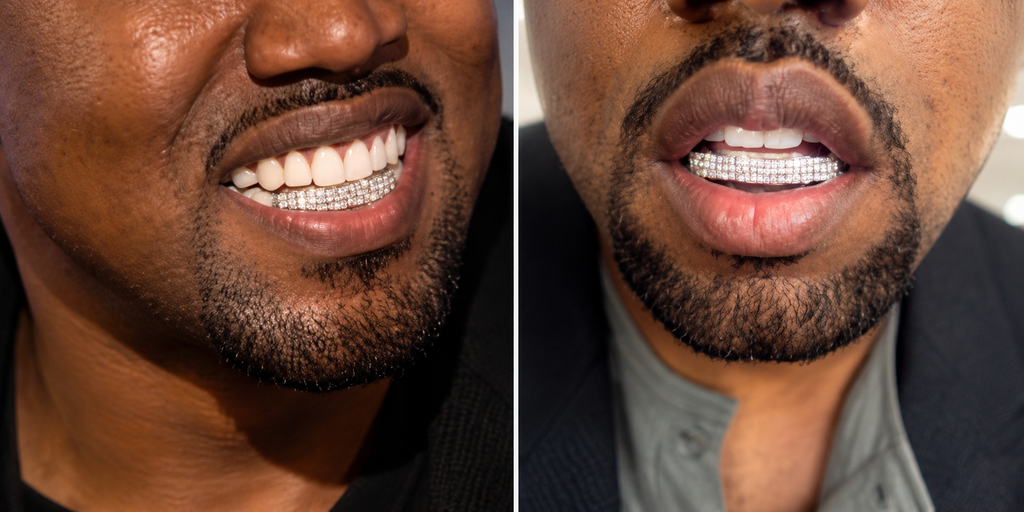 JDWR-S105-KANYE WEST'S CHOICE GRILLZ