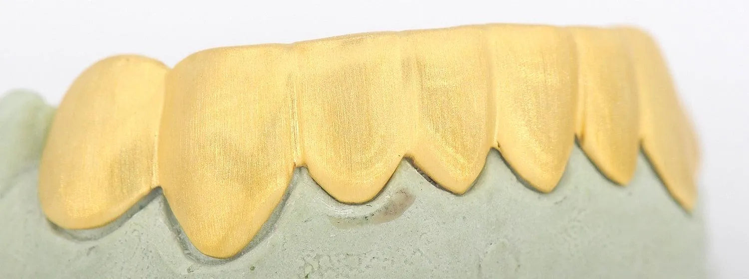 JDTK-S161706-1A 6 Teeth Sand Finish - Johnny Dang & Co