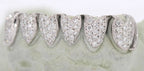 JDTK-2042 - 6 TOP OR 6 BOTTOM SI Hand prong Heart Diamond Grillz - Johnny Dang & Co