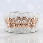 JDWR-S2530073 Custom Gold Teeth