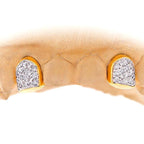 2 PRONG SET CUSTOM COLOR DIAMOND TEETH - Johnny Dang & Co