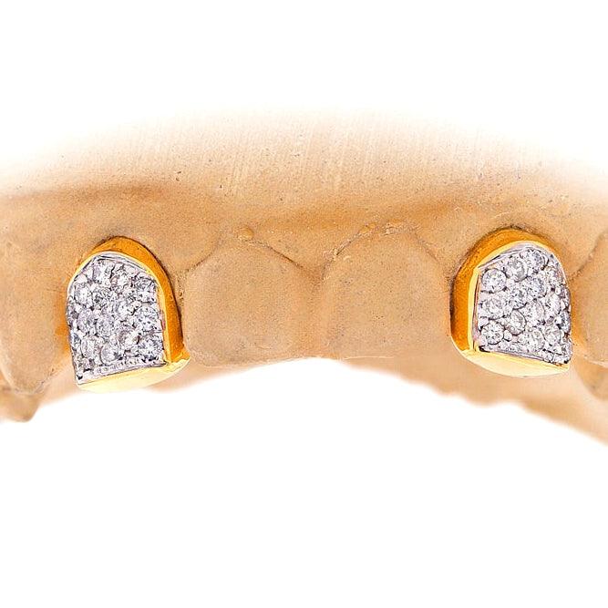 2 PRONG SET CUSTOM COLOR DIAMOND TEETH - Johnny Dang & Co