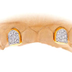 2 PRONG SET CUSTOM COLOR DIAMOND TEETH - Johnny Dang & Co