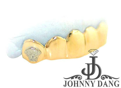JDTK-S2530073 Custom Gold Teeth - Johnny Dang & Co