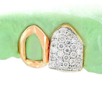 JDTK-S151706-2 INDIVIDUAL HAND PRONG SET AND OPEN FACE - Johnny Dang & Co