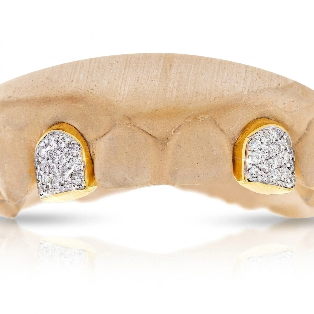 JDWR-0047-2 PRONG SET CUSTOM COLOR DIAMOND TEETH