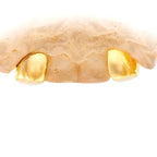 2 PRONG SET CUSTOM COLOR DIAMOND TEETH - Johnny Dang & Co