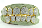 JDTK-G16-CHANDELIER - SI/VS/VVS Diamond Special Hand Prong Set Permanent Diamond Cap - Johnny Dang & Co