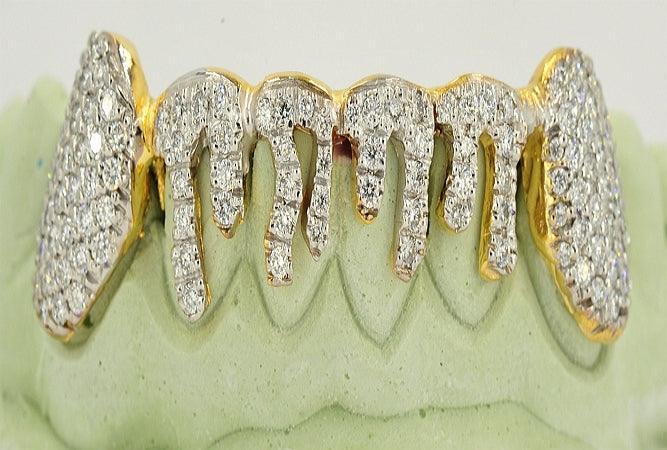 JDTK-2024 - 6 TOP OR 6 BOTTOM SI Hand prong Dripping Diamond Grillz - Johnny Dang & Co