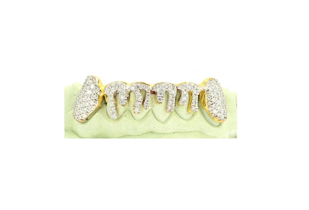 JDTK-2024 - 6 TOP OR 6 BOTTOM SI Hand prong Dripping Diamond Grillz - Johnny Dang & Co