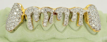 JDTK-2024 - 6 TOP OR 6 BOTTOM SI Hand prong Dripping Diamond Grillz - Johnny Dang & Co