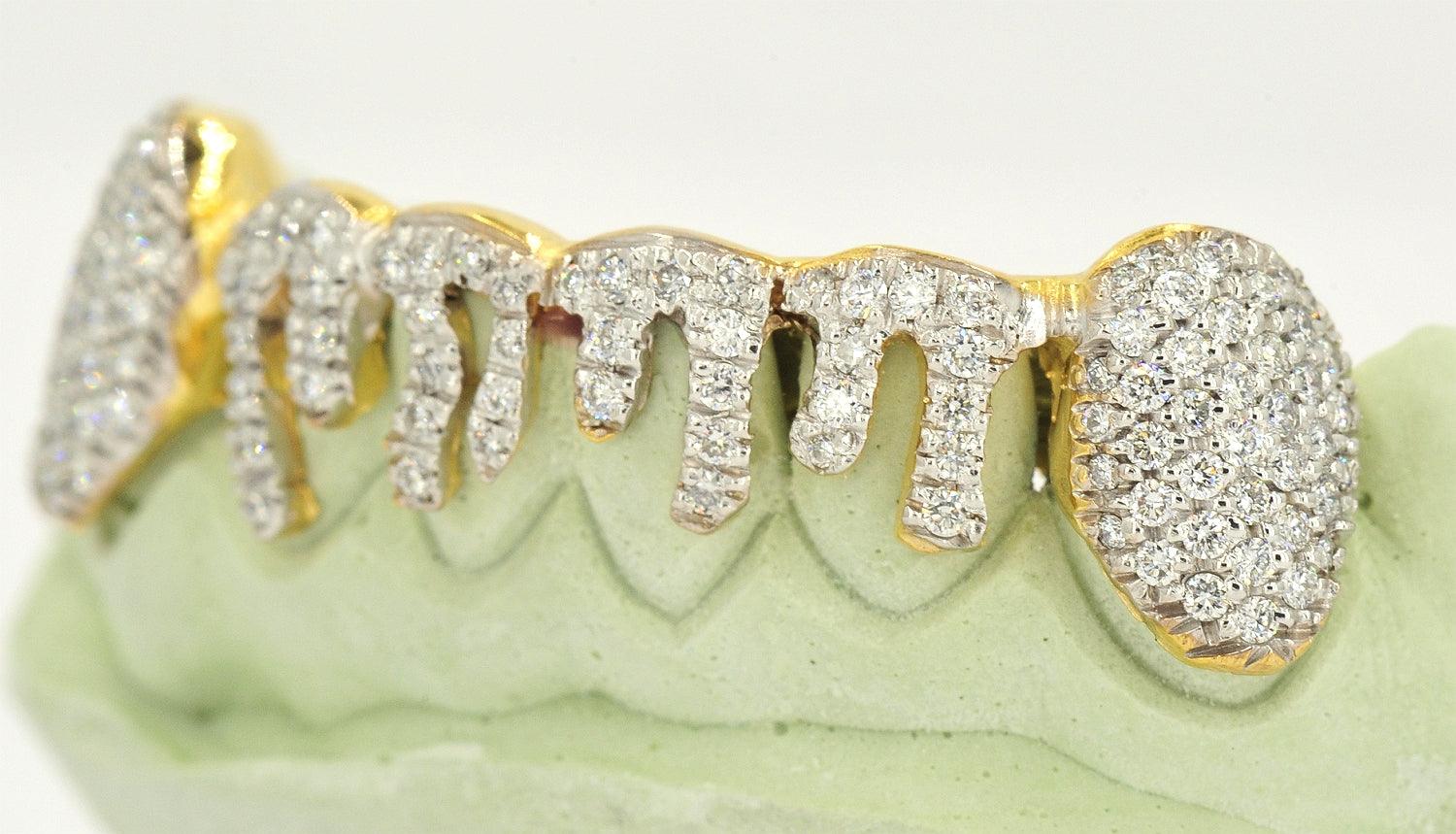 JDTK-2024 - 6 TOP OR 6 BOTTOM SI Hand prong Dripping Diamond Grillz - Johnny Dang & Co