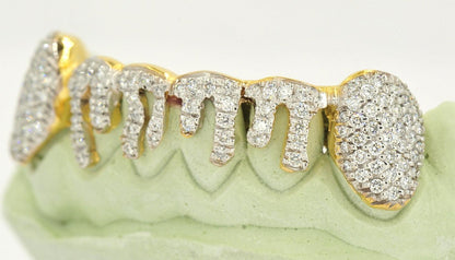 JDTK-2024 - 6 TOP OR 6 BOTTOM SI Hand prong Dripping Diamond Grillz - Johnny Dang & Co