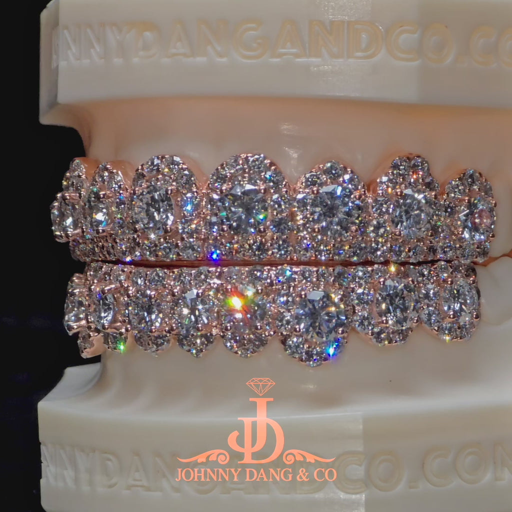 JDWR-2026-35 NO GIA "Honeymoon" Set Grillz Rose Gold (Pull Out)