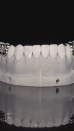 JDWR-V1-CUSTOM-DENTAL-VENEERS