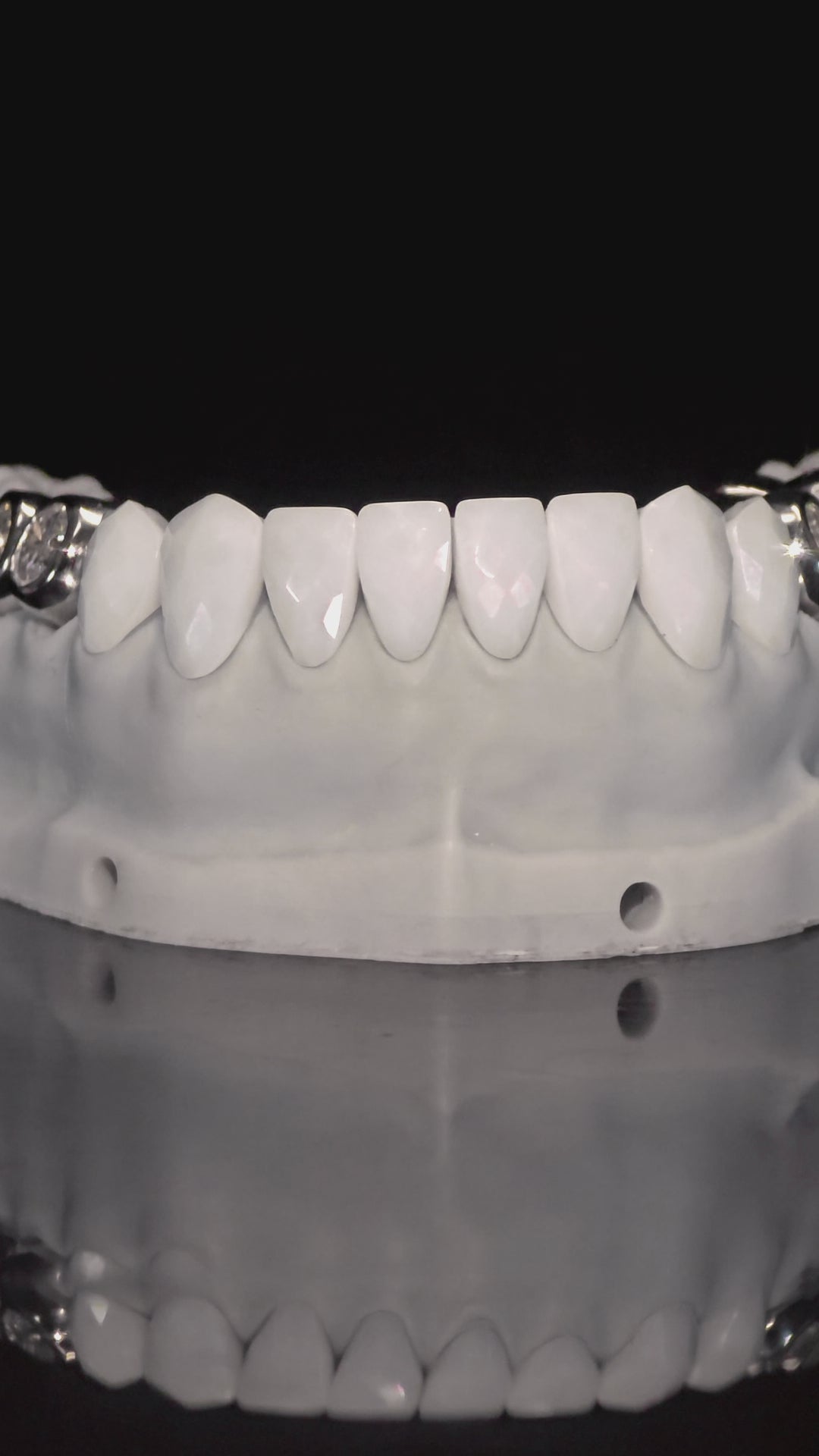 JDWR-V1-CUSTOM-DENTAL-VENEERS