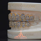 JDWR-2026-30 Flawless Mosaic Set Grillz Yellow Gold (Pull Out)
