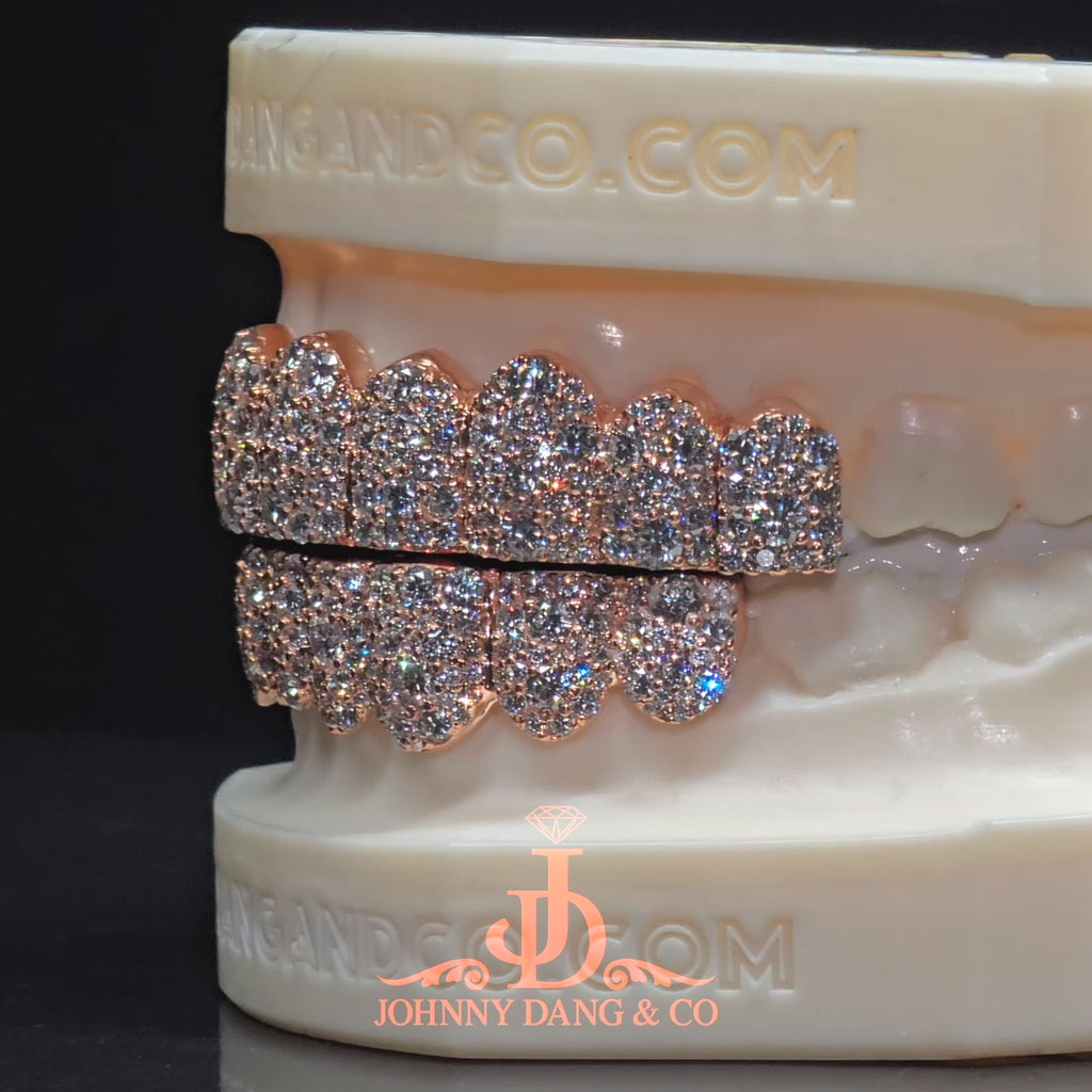 JDWR-2026-28 Flawless Mosaic Set Grillz Rose Gold (Pull Out)