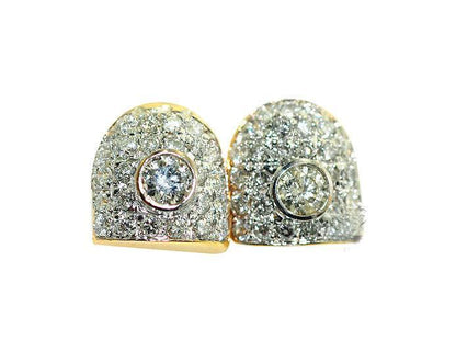 JDTK-S2530075c Permanent Prong and Bezel Set Gold Teeth - Johnny Dang & Co