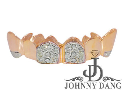 JDTK-S2530030 - Gold Teeth - Johnny Dang & Co