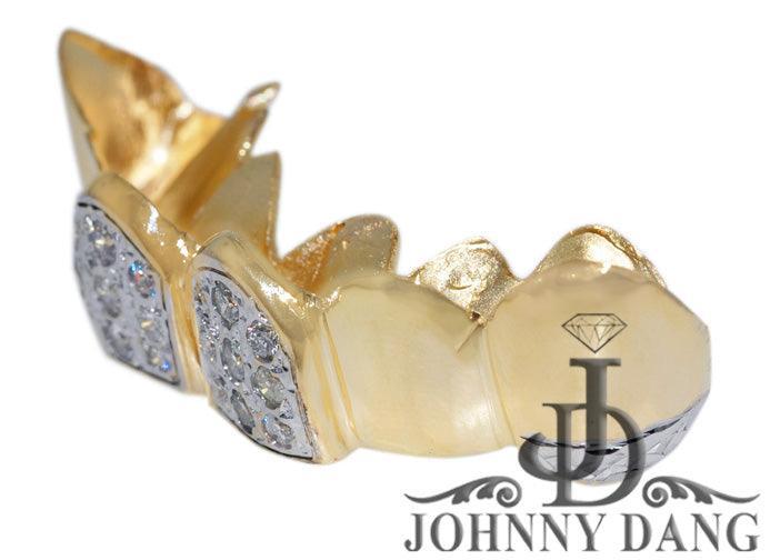 JDTK-S2530030 - Gold Teeth - Johnny Dang & Co