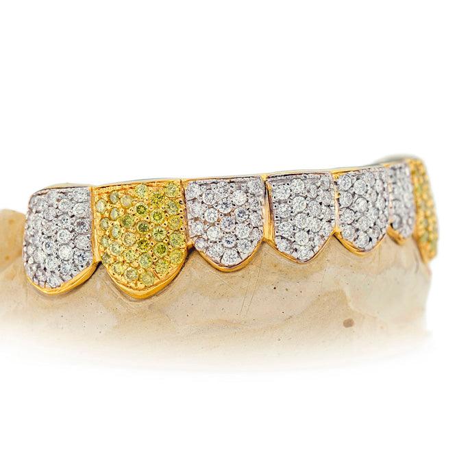 JDTK-101 - 8 TOP OR 8 BOTTOM SI Hand prong Diamond Grillz - Johnny Dang & Co