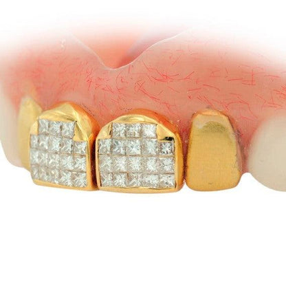 JDTK-DTG1 - FOUR INDIVIDUAL TEETH DENTURE GRILL - Johnny Dang & Co